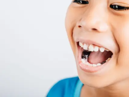 webp/Pediatric-Root-Canal-Treatment-for-Kids-Row-1-Kid-Grins.webphfazwz.webp webp/Pediatric-Root-Canal-Treatment-for-Kids-Row-1-Kid-Grins.webphfazwz.webp