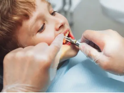 Possible Root Canal Alternatives for Kids - Kid Grins Shows You All the Possible Alternatives Possible Root Canal Alternatives for Kids - Kid Grins Shows You All the Possible Alternatives